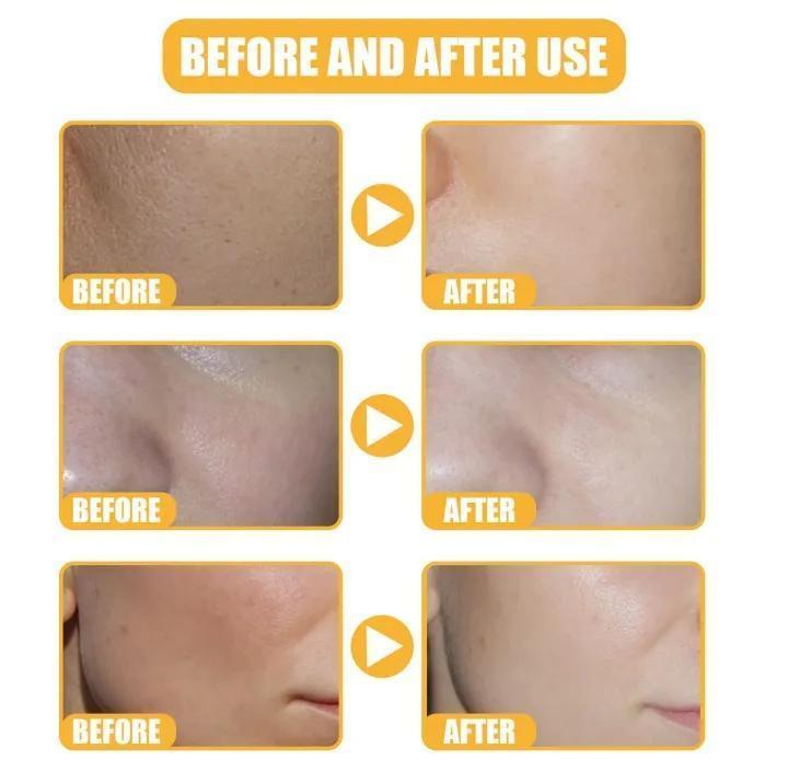 Uptown La Whitening Rice Essence Serum