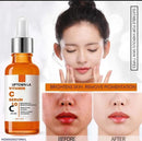 Uptown La Skin Brightening Vitamin-C Serum