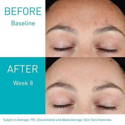 Barrier Protection Face Serum