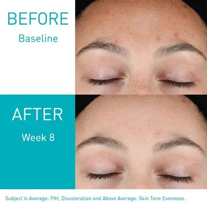 Barrier Protection Face Serum