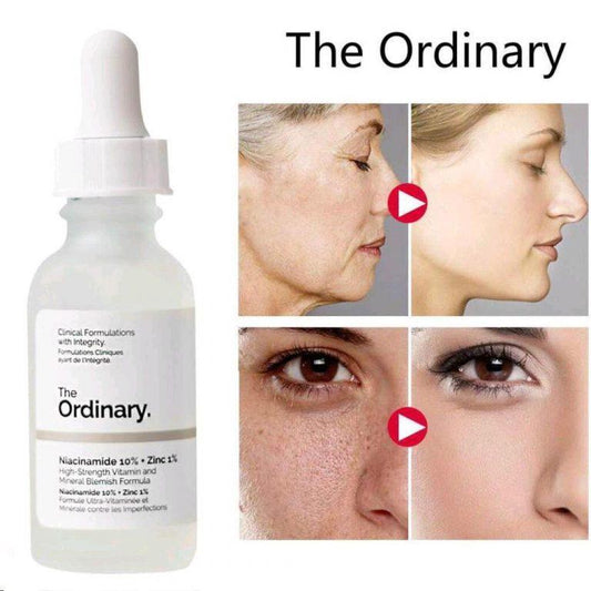 Skin Brightening Niacinamide Serum
